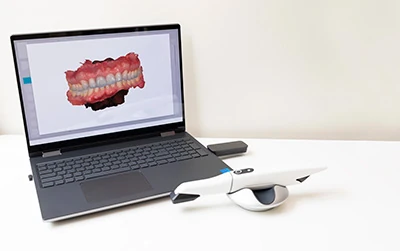 intraoral camera used at CareSmiles Dental