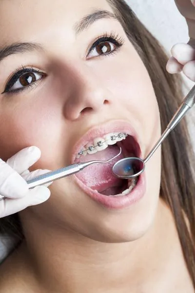 girl getting orthodontic treatment at CareSmiles Dental
