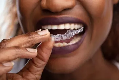 woman putting in her new clear aligners from CareSmiles Dental