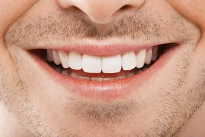 man showing his freshly cleaned smile thanks to gum disease treatment at CareSmiles Dental